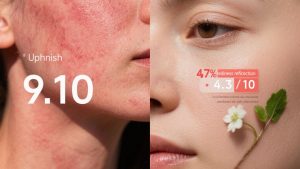 舒缓晒伤肌肤的首选成分？积雪草提取物